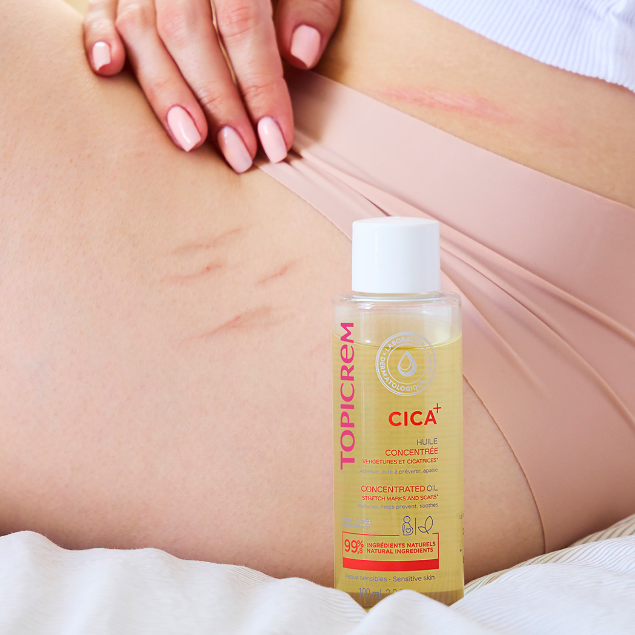 CONCENTRATED OIL FOR STRETCH MARKS AND SCARS