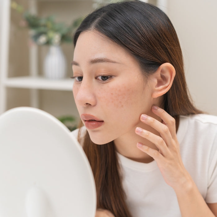 FEMME-AVEC-ACNE-QUI-SE-REGARDE-DANS-LE-MIROIR