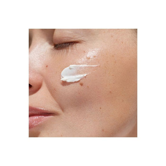 Hyperpigmentation : pourquoi les taches apparaissent-elles et comment les atténuer ?