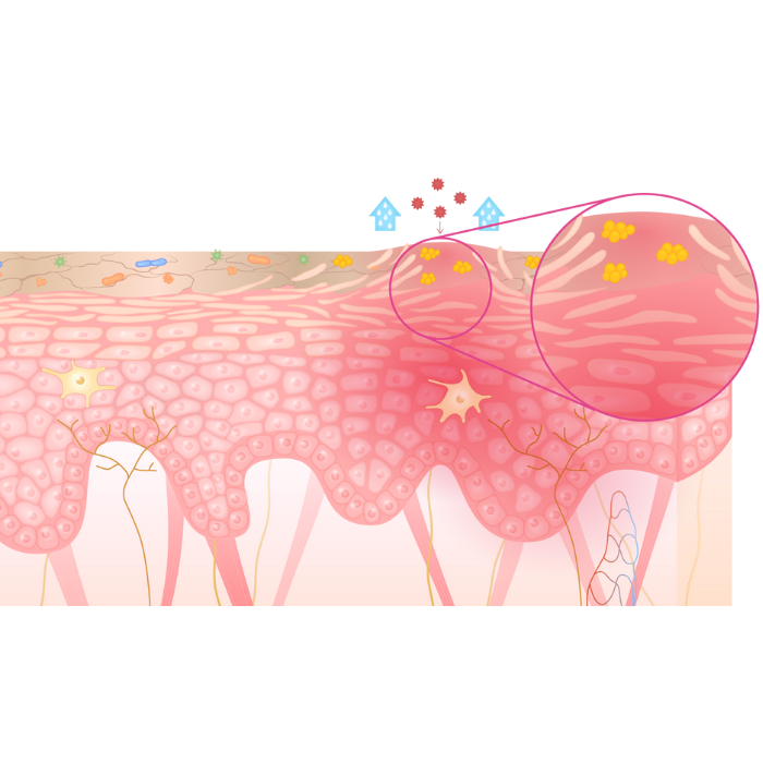 Une coupe de peau scientifique de la peau atopique 
