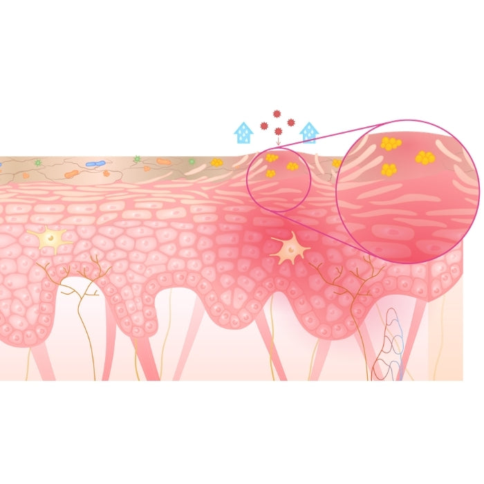 Coupe de peau d'une peau atopique, sensible aux agressions extérieures et intérieures