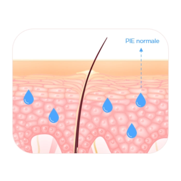 Coupe de peau illustrant la perte insensible en eau 