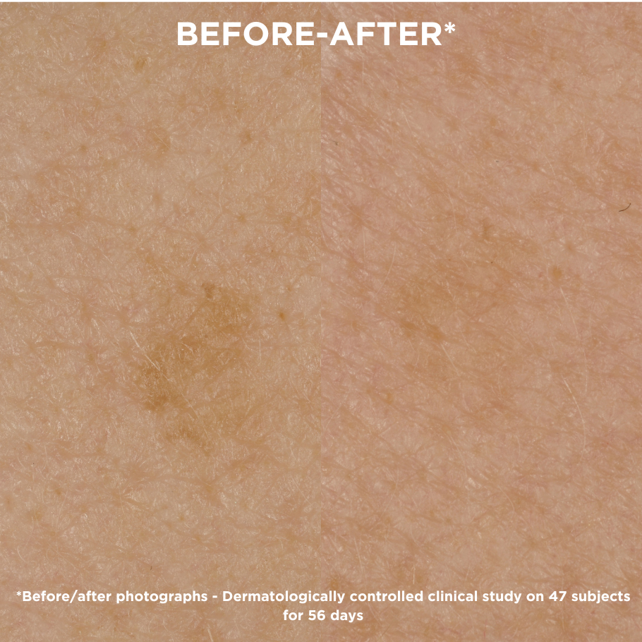 Unifying, anti-blemish care & creams for face and body | MELA – Topicrem